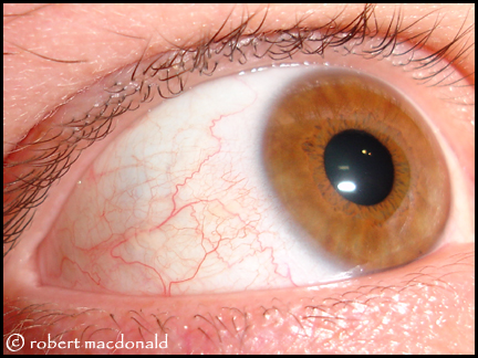 My Eye