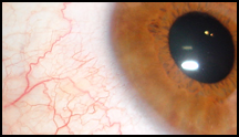 My Eye