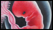 Doomed Fetus