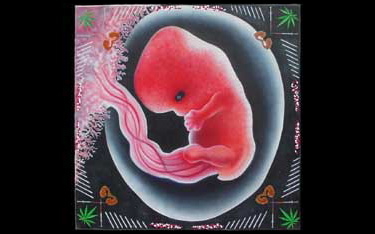 Doomed Fetus